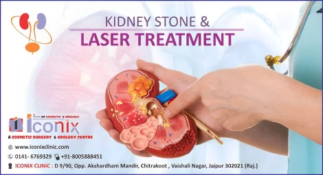 Dr Arjun Singh Shekhawat (Senior Urologist) Director of Iconix Clinic -Urology, Andrology and Kidney disease center answered about all the details/queries regarding laser lithotripsy.